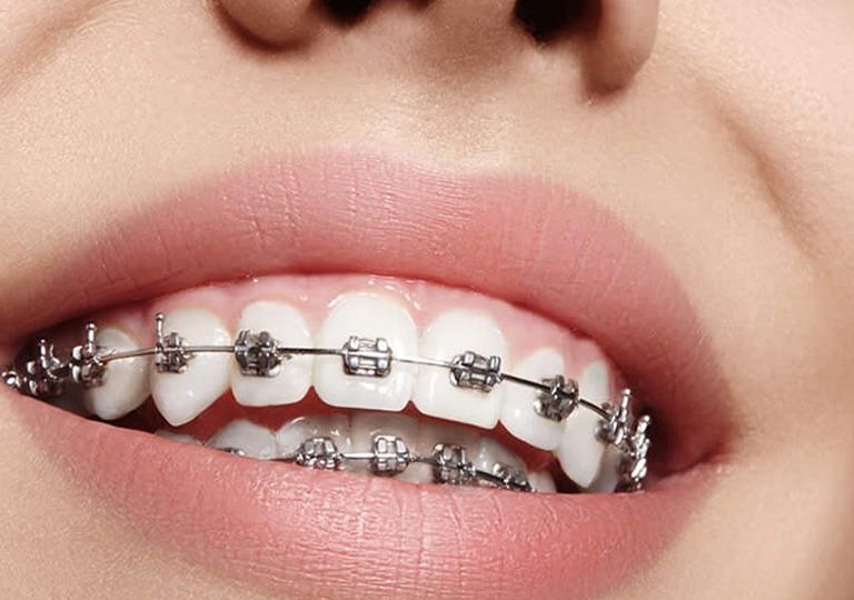 neden gülüş akademisi ortodonti